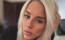 «Исполнила мечту»: Яна Кудрявцева решилась на пластическую операцию